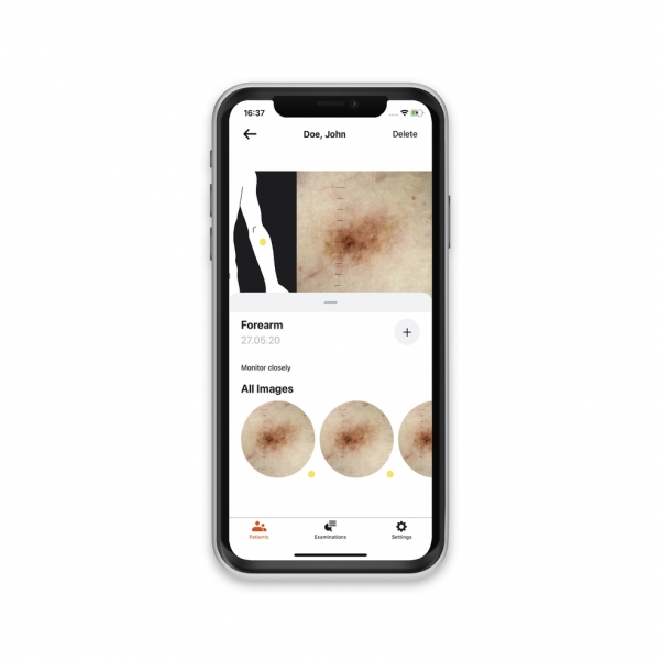 Aplikacja HEINE DERM